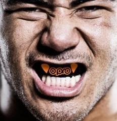 Mouthguards