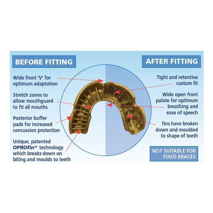 Opro MULTI-ITEM F3424      ~ OPRO SILVER MOUTHGUARD JUNIOR New zealand nz vaughan